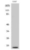 Cathepsin D antibody, GTX86884, GeneTex, Western Blot image 