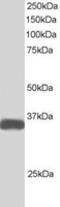 STE20 Related Adaptor Beta antibody, MBS420020, MyBioSource, Western Blot image 