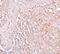 Solute Carrier Family 39 Member 8 antibody, 6095, ProSci, Immunohistochemistry paraffin image 