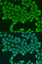 ATP Synthase Peripheral Stalk Subunit OSCP antibody, 23-401, ProSci, Immunofluorescence image 