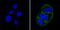 Insulin Receptor antibody, MA5-13759, Invitrogen Antibodies, Immunofluorescence image 