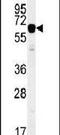Insulin Like Growth Factor 2 MRNA Binding Protein 2 antibody, PA5-23636, Invitrogen Antibodies, Western Blot image 