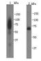 Death Associated Protein Kinase 1 antibody, orb195509, Biorbyt, Western Blot image 