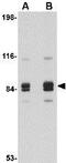 Syntaphilin antibody, GTX85393, GeneTex, Western Blot image 