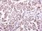 Killer Cell Lectin Like Receptor K1 antibody, GTX104761, GeneTex, Immunohistochemistry paraffin image 