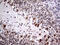 Neuronal PAS Domain Protein 1 antibody, M10933, Boster Biological Technology, Immunohistochemistry paraffin image 