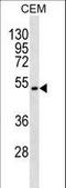 Target Of Myb1 Like 2 Membrane Trafficking Protein antibody, LS-C157239, Lifespan Biosciences, Western Blot image 