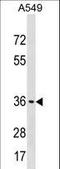 ADP-Ribosyltransferase 5 antibody, LS-C159127, Lifespan Biosciences, Western Blot image 