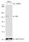 AXL Receptor Tyrosine Kinase antibody, NBP2-15530, Novus Biologicals, Western Blot image 