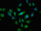 ATP Binding Cassette Subfamily C Member 3 antibody, LS-C672054, Lifespan Biosciences, Immunofluorescence image 