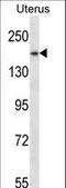 Structural Maintenance Of Chromosomes 1B antibody, LS-C161311, Lifespan Biosciences, Western Blot image 