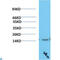 Transthyretin antibody, LS-C813245, Lifespan Biosciences, Western Blot image 