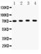 Potassium Voltage-Gated Channel Subfamily D Member 1 antibody, LS-C357419, Lifespan Biosciences, Western Blot image 