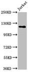 Sterol Regulatory Element Binding Transcription Factor 1 antibody, CSB-PA022657LA01HU, Cusabio, Western Blot image 