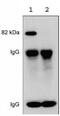 Protein Kinase C Alpha antibody, ab23513, Abcam, Western Blot image 