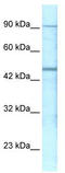 Gamma-Aminobutyric Acid Type A Receptor Pi Subunit antibody, TA330439, Origene, Western Blot image 