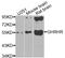 Growth Hormone Releasing Hormone Receptor antibody, STJ110719, St John