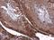 Tight Junction Protein 1 antibody, GTX108613, GeneTex, Immunohistochemistry paraffin image 