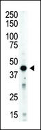 Aurora Kinase B antibody, LS-C100777, Lifespan Biosciences, Western Blot image 