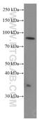 Stromal Interaction Molecule 1 antibody, 66189-1-Ig, Proteintech Group, Western Blot image 