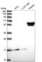 Zinc Finger Protein 317 antibody, NBP2-58269, Novus Biologicals, Western Blot image 