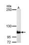 Phosphatidylinositol-4,5-Bisphosphate 3-Kinase Catalytic Subunit Beta antibody, NBP1-33116, Novus Biologicals, Western Blot image 