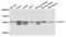 3-Oxoacid CoA-Transferase 1 antibody, A8139, ABclonal Technology, Western Blot image 