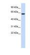 Leucine Rich Repeat And Ig Domain Containing 4 antibody, NBP1-70601, Novus Biologicals, Western Blot image 