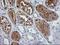 Sirtuin 5 antibody, LS-C173171, Lifespan Biosciences, Immunohistochemistry paraffin image 