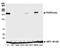 Platelet Derived Growth Factor Receptor Beta antibody, NBP2-78835, Novus Biologicals, Western Blot image 