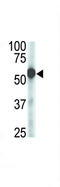 Zinc Metallopeptidase STE24 antibody, LS-C99715, Lifespan Biosciences, Western Blot image 