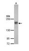 Erb-B2 Receptor Tyrosine Kinase 4 antibody, PA5-29272, Invitrogen Antibodies, Western Blot image 