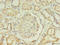 Aminoadipate Aminotransferase antibody, LS-C397715, Lifespan Biosciences, Immunohistochemistry paraffin image 