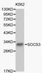Suppressor Of Cytokine Signaling 3 antibody, LS-C192276, Lifespan Biosciences, Western Blot image 
