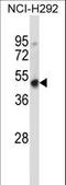 Homeobox D3 antibody, LS-C164418, Lifespan Biosciences, Western Blot image 