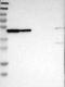Proliferation-Associated 2G4 antibody, NBP1-90369, Novus Biologicals, Western Blot image 