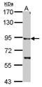 Inhibitor Of Nuclear Factor Kappa B Kinase Subunit Beta antibody, TA308825, Origene, Western Blot image 