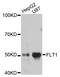 Fms Related Tyrosine Kinase 1 antibody, STJ112545, St John