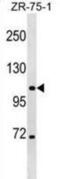 Chloride Voltage-Gated Channel 3 antibody, abx029323, Abbexa, Western Blot image 