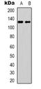 Ubiquitin Protein Ligase E3B antibody, LS-C368937, Lifespan Biosciences, Western Blot image 