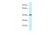 Purinergic Receptor P2X 2 antibody, PA5-68694, Invitrogen Antibodies, Western Blot image 