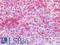 Interferon Alpha And Beta Receptor Subunit 1 antibody, LS-B16469, Lifespan Biosciences, Immunohistochemistry paraffin image 