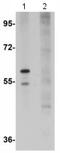 Schlafen Family Member 12 antibody, ab113238, Abcam, Western Blot image 