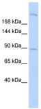 Shroom Family Member 2 antibody, TA338520, Origene, Western Blot image 