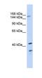 ATP Binding Cassette Subfamily C Member 8 antibody, orb330321, Biorbyt, Western Blot image 