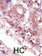 Serine/Threonine Kinase 33 antibody, 63-139, ProSci, Immunohistochemistry paraffin image 