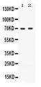 Zeta Chain Of T Cell Receptor Associated Protein Kinase 70 antibody, PB9968, Boster Biological Technology, Western Blot image 