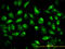 Testin LIM Domain Protein antibody, LS-B6222, Lifespan Biosciences, Immunofluorescence image 