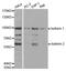 Ubiquitin Like With PHD And Ring Finger Domains 2 antibody, PA5-37441, Invitrogen Antibodies, Western Blot image 