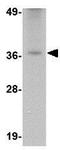 Three Prime Repair Exonuclease 2 antibody, GTX85021, GeneTex, Western Blot image 